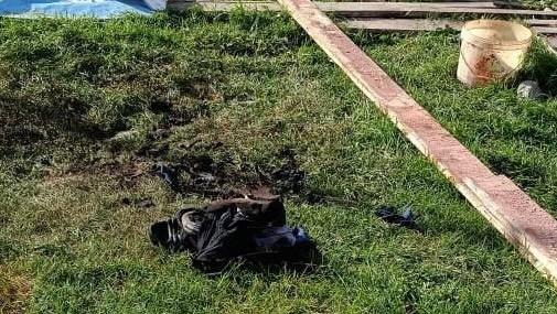 В Башкирии мужчина получил страшные ожоги при курении В Башкирии мужчина получил страшные ожоги при курении