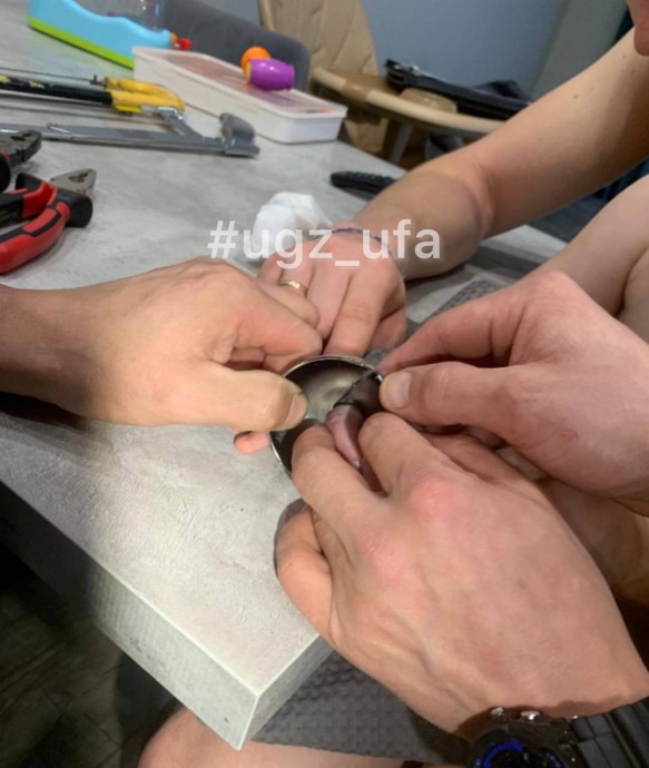 В Уфе спасатели освободили палец двухлетней девочки В Уфе спасатели освободили палец двухлетней девочки