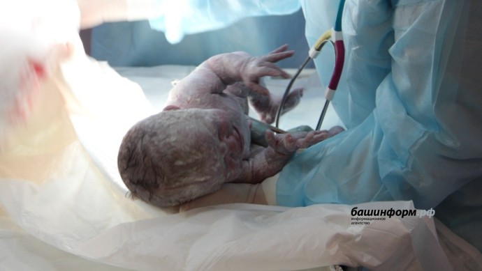 В Башкирии врачи успешно приняли роды у женщины с редкой болезнью крови В Башкирии врачи успешно приняли роды у женщины с редкой болезнью крови