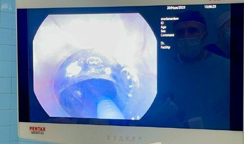 Не могла проглотить даже воду: в НИИ скорой помощи им. И.И. Джанелидзе помогли пациентке с редкой патологией пищевода