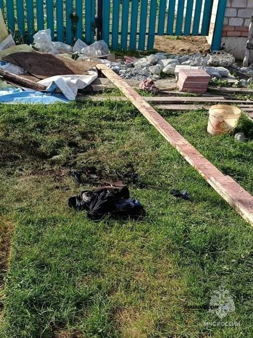 Житель Башкирии получил страшные ожоги при курении Житель Башкирии получил страшные ожоги при курении