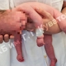1 случай на 10 000: В Уфе родился малыш с синдромом Прадера-Вилли