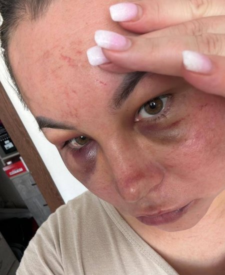 Жительница Башкирии стала жертвой домашнего тирана