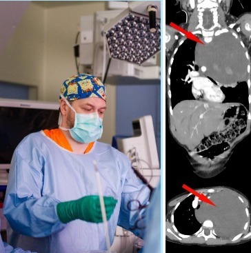 Врачи удалили огромную опухоль у маленькой девочки из Уфы Врачи удалили огромную опухоль у маленькой девочки из Уфы