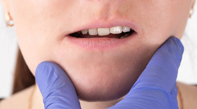 Ортодонт Радько: неправильный прикус может стать причиной развития гайморита