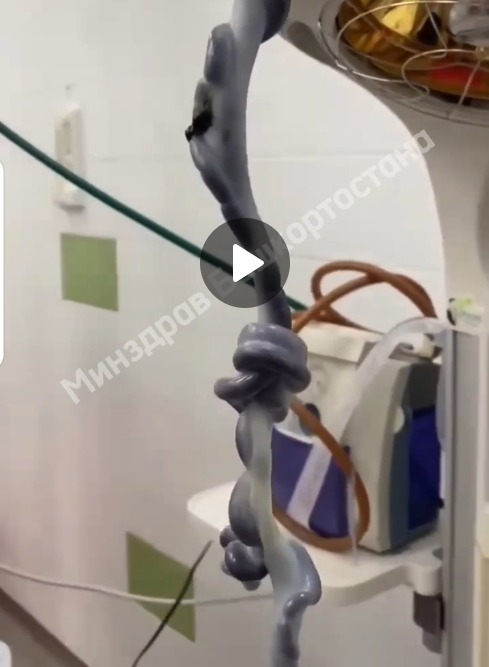 В Уфе появился на свет ребёнок с уникальной пуповиной