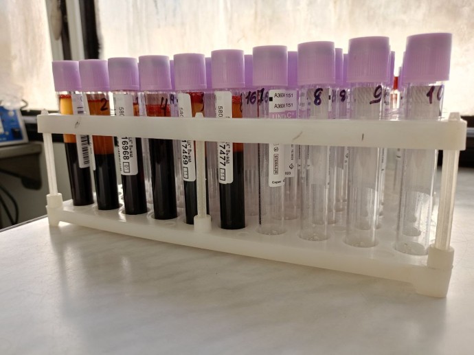 Кто чаще болеет ВИЧ в Пензенской области: свежая статистика Кто чаще болеет ВИЧ в Пензенской области: свежая статистика