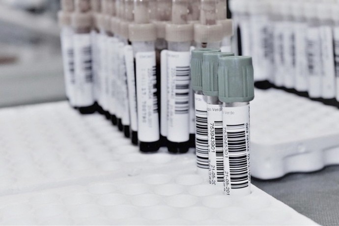 Падает или растет: Назван здоровый уровень сахара в крови для мужчин