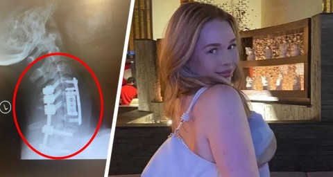 Туристка была «частично обезглавлена» во время отпуска в Турции
