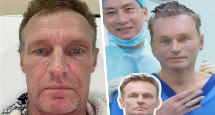 Вьетнамский переворот: турист превратился из мужика в мальчика и стал звездой TikTok после косметической операции за $4000 Вьетнамский переворот: турист превратился из мужика в мальчика и стал звездой TikTok после косметической операции за $4000