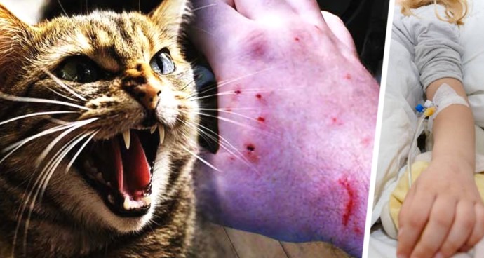 «Мои собаки спасли мне жизнь после того, как меня укусила бешеная кошка в Турции»