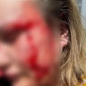 Жестоким избиением жительницы Владивостока занялась полиция