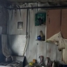 В Башкирии от ожогов погиб 43-летний мужчина