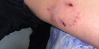 Собака покусала пятилетнего мальчика прямо во дворе детского сада
