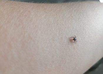 В Приамурье выявили клеща с вирусным энцефалитом