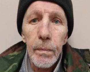 В Пензе разыскивают мужчину со шрамом на лице