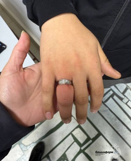 В Башкирии подросток едва не лишился пальца из-за кольца В Башкирии подросток едва не лишился пальца из-за кольца