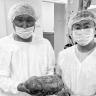 У жительницы  Бурятии удалили гигантскую опухоль