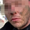 Задержан мужчина, растерзавший и обокравший женщину на 2-й Комсомольской