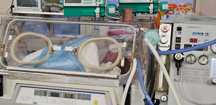 В стационаре Мариинской больницы рoдились исключительные малыши
