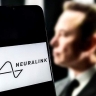 Второму в мире человеку вживили чип от Neuralink