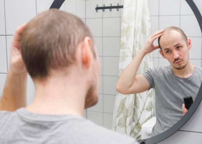 Плохие новости для вечера субботы - от регулярных доз алкоголя выпадают волосы Плохие новости для вечера субботы - от регулярных доз алкоголя выпадают волосы