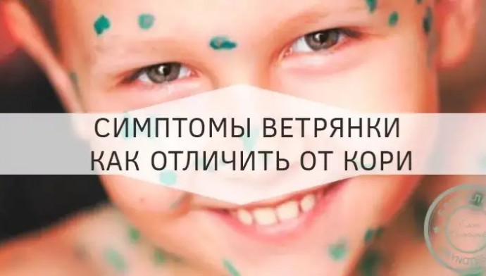 Сыпь при кори и сыпь при ветрянке — в чем разница? Сыпь при кори и сыпь при ветрянке — в чем разница?