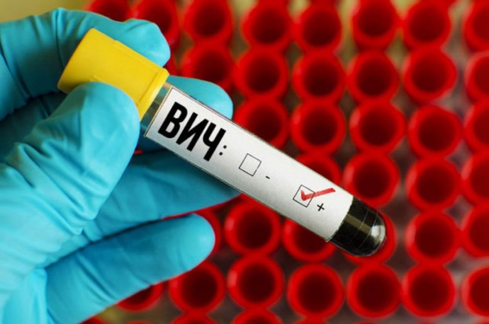 В России каждый сотый человек заражен ВИЧ В России каждый сотый человек заражен ВИЧ