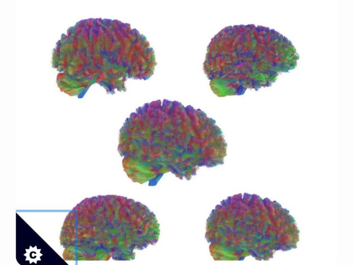 Учёные выделили пять возрастных этапов развития человеческого мозга Учёные выделили пять возрастных этапов развития человеческого мозга